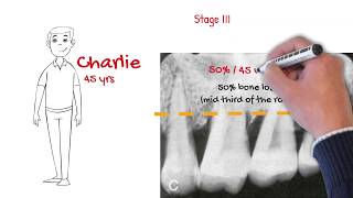 The new periodontal classification MUST WATCH FOR ALL DENTISTS [upl. by Farrison694]