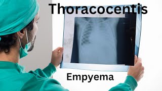 lung empyema empyema lungs effusion puslungdiseases respiratorydiseases thoracocentisis [upl. by Prosperus814]