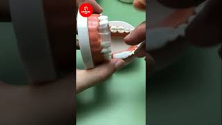 Fix your chipped or broken teeth at home easy DIY TOOTH BONDING  Life Hacks Box [upl. by Kirt]