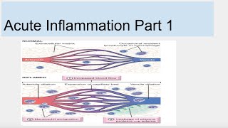 Acute Inflammation Part 1 [upl. by Ferren]