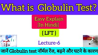 What is Globulin test  Globulin test normal range High and Low Causes of Globulin level in blood [upl. by Yanttirb360]