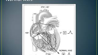 12 Lead ECG Interpretation – Part 1 [upl. by Langsdon]