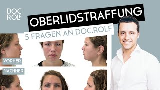 OBERLIDSTRAFFUNG OP bei Schlupflidern [upl. by Gabel]