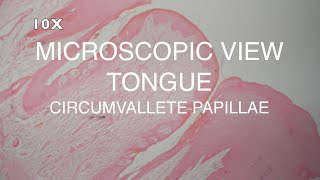 MICROSCOPIC VIEW  TONGUE CIRCUMVALLATE PAPILLAE [upl. by Juditha559]