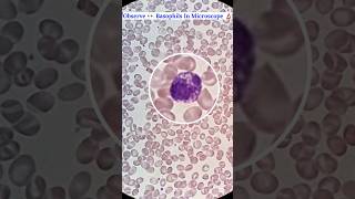 Observe 👀 Basophils Cells Seen In Microscope 🔬 shorts science ytshorts mbbs [upl. by Eiramnaej]