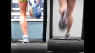 Shin Splint  Video Analysis RunSmart Online [upl. by Eerahc119]