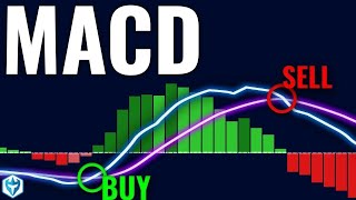 How I Nailed Trading with the MACD Indicator StepbyStep Guide [upl. by Zobias442]