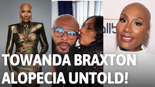 Towanda Braxton Alopecia Untold [upl. by Akehsal]