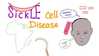 Sickle Cell Disease “Part 1” Intro [upl. by Schick820]