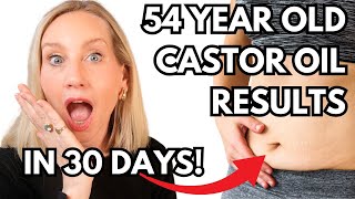 SHOCKING CASTOR OIL RESULTS AFTER 30 Days As a Woman Over 50 [upl. by Atiuqehs]