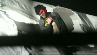 Chilling photos of Boston bombing suspect when captured [upl. by Armanda]