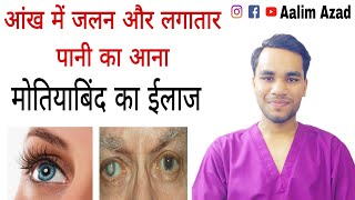 Best Eye Exercises To Improve Your Vision  Aalim Azad eyetreatment viralvideo cuppingtherapy yt [upl. by Yelhsa]