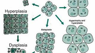 Difference Between Hyperplasia and Hypertrophy [upl. by Hamon290]