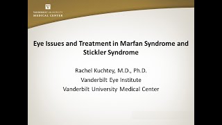 Eye Issues and Treatment in Marfan Syndrome Stickler Syndrome and Other Related Conditions [upl. by Borer]