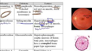 USMLE ACE Video 29 Enzyme Deficiencies and Their Associated Lysosomal Storage Diseases [upl. by Yob]