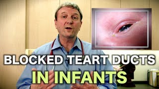 Blocked Tear Ducts in Infants Pediatric Advice [upl. by Sherfield367]