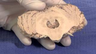 The Cerebellum Neuroanatomy Video Lab  Brain Dissections [upl. by Arriat]