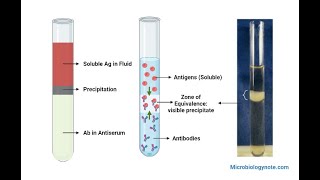 Ring Precipitation Test Principle Procedure Result [upl. by Maurilia]