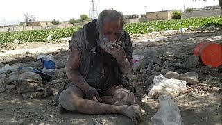 This is the dirtiest man alive  he hasnt showered for more than 60 years  smokes animal feces [upl. by Asenev421]