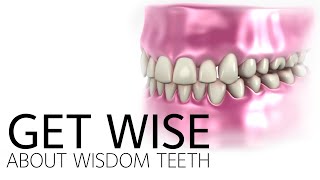 Get Wise About Wisdom Teeth [upl. by Aneertak]