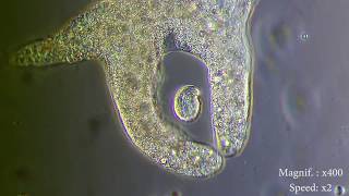 Amoeba eats paramecia  Amoebas lunch   Amoeba Endocytosis  Phagocytosis Part 1  👌 [upl. by Chi]