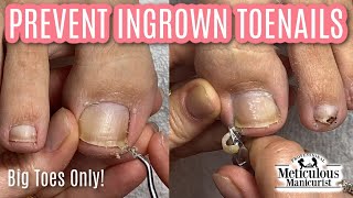 👣Big Toes Only  Mr Meticulous Deep Sidewall Cleaning to Prevent Ingrown Toenails👣 [upl. by Lal]