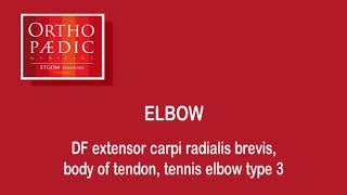 Transverse friction massage tennis elbow type 3 [upl. by Kemble]