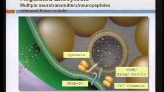 Spasticity Management [upl. by Schwab840]