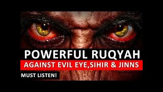 Ruqyah Shariah to Remove Black Magic amp BAD EYE RightSword [upl. by Desireah]