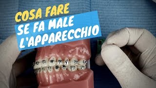 Fa male lapparecchio Ecco cosa fare [upl. by Kemeny168]