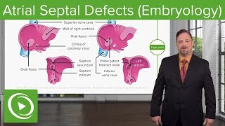 Atrial Septal Defects – Embryology  Lecturio [upl. by Atsirak]