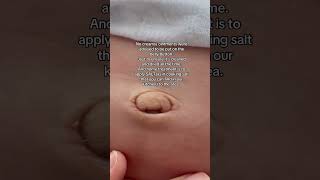 Umbilical granuloma umbilicalcord granuloma newborn baby firsttimemom firsttimeparents [upl. by Siraved]