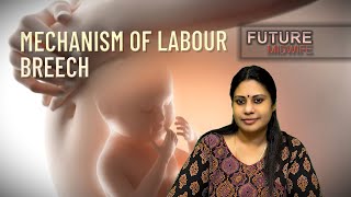 MECHANISM OF LABOURBREECH PRESENTATIONDHANYA DEEPUOBGHIGH RISK LABOUR [upl. by Os580]