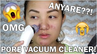 PORE VACCUM CLEANER GONE WRONG  UNBOXING REVIEW amp DEMO ♡ Shen Asidor [upl. by Soinotna]