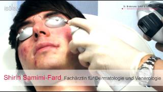 AKNE LIVEBEHANDLUNG  Isolaz und Fraxel Laser  DERMA LOFT Gladbeck [upl. by Nonnaehr]