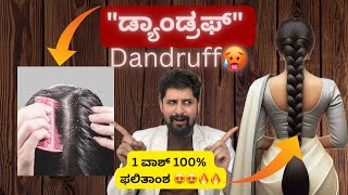 “ಡ್ಯಾಂಡ್ರಫ್quot  Dandruff  1 ವಾಶ್ 100 ಫಲಿತಾಂಶ😍🔥 [upl. by Aitnuahs]