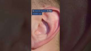 Tinnitus EXPOSED  Surprising Causes of Ringing in Ears 6 [upl. by Ykcaj]