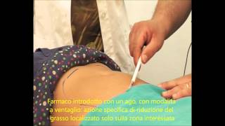 INTRALIPOTERAPIA AQUALYX AL CENTROMEID [upl. by Eidnalem333]