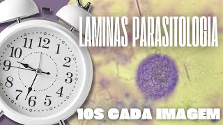 PARASITOLOGIA  10S PARA ACERTAR AS IMAGENS DAS LAMINAS [upl. by Lunetta]