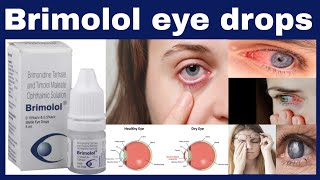 Brimolol eye drops uses in hindi  Timolol 5 mg  Brimonidine 15 mg benefits Side Effects [upl. by Aenneea]