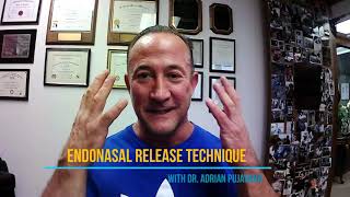 Endonasal Release Technique [upl. by Sorac]