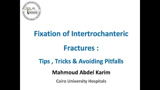 Fixation of Intertrochanteric Fractures Tips  Tricks amp Avoiding Pitfalls [upl. by Sly]