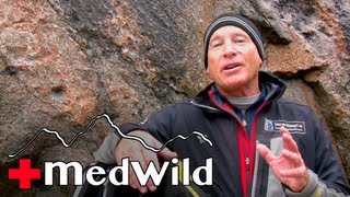 Wilderness Medicine How To Prepare For High Altitudes [upl. by Yartnod542]