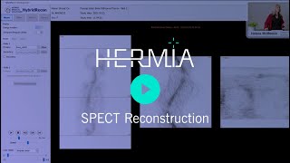 HERMIA SPECT Reconstruction [upl. by Dud]