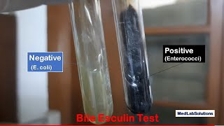 Bile Esculin Test Positive and Negative Demonstration [upl. by Odey]