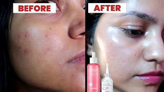 THESE CERAMIDE SERUMS DO WONDERS [upl. by Rivy]