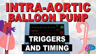 Intraaortic balloon pump troubleshooting [upl. by Gnik]