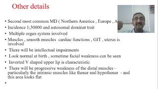 Muscular Dystrophy  Myotonic Dystrophy  Part 10 [upl. by Anirbys582]