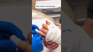 Easy way to remove Ring from burn hand or broken fingers youtubeshorts ringremove tips [upl. by Templer]