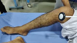 Hyperreflexia Ankle and Knee Reflex [upl. by Ahsilam]